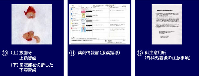 手順4